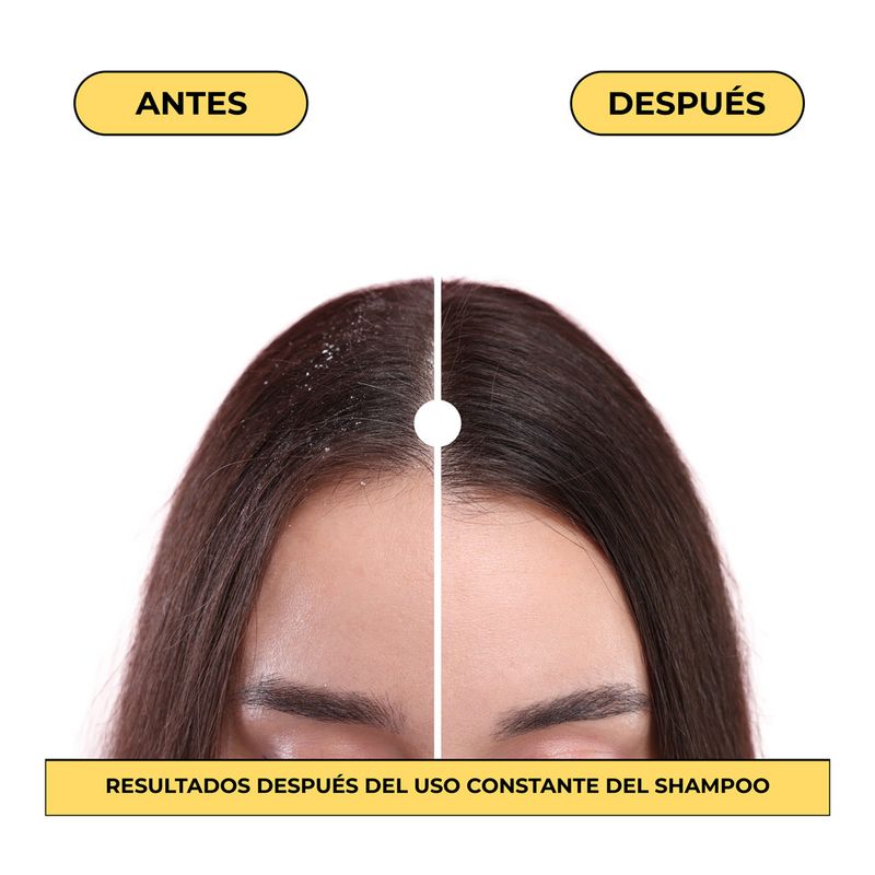 5912998-Shampoo-Naissant-Control-Caspa-X300ml-5
